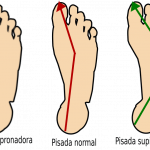Pisada pronadora, supinadora, normal