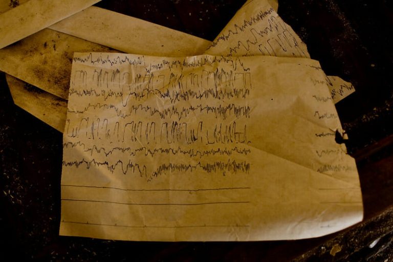 electroencefalograma